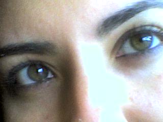 aletis